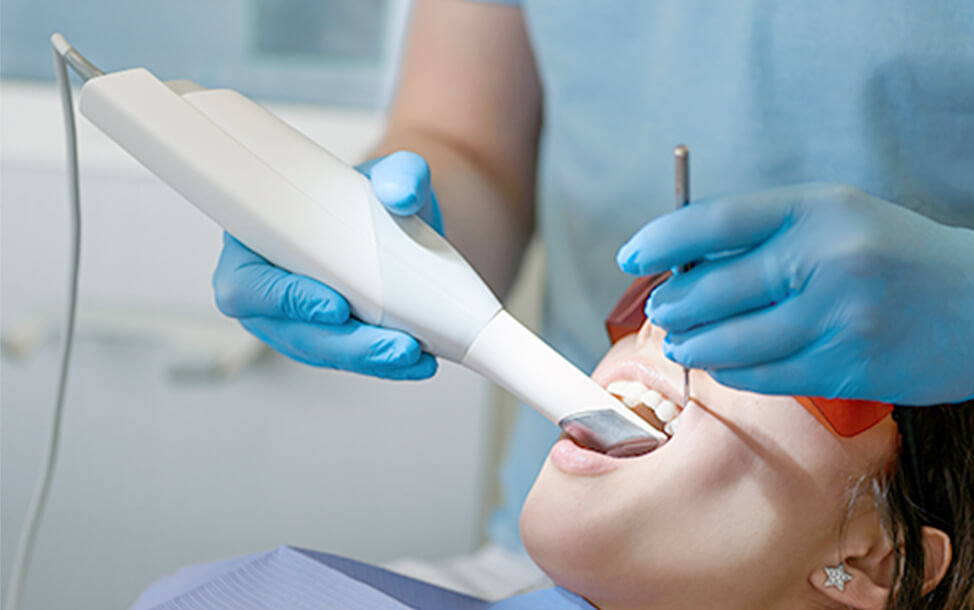 3D口腔内スキャナー「iTero」