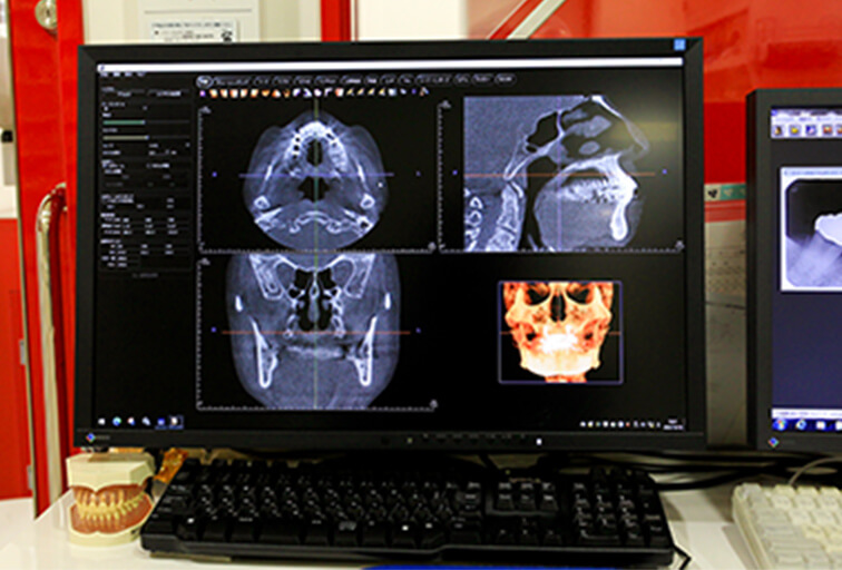 治療計画・初期治療