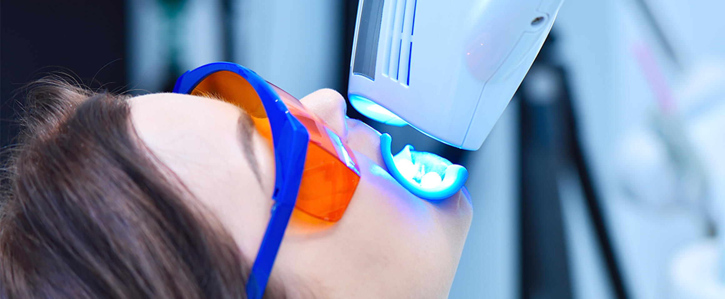 オフィスホワイトニング